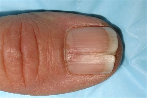 Maybe you would like to learn more about one of these? Some Simple Tips & Ways To Stop Nails Splitting | Split ...