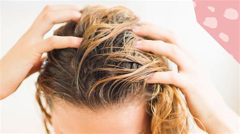 What Causes Scalp Acne How To Treat Pimples On Your Scalp Ph