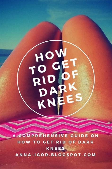 A Comprehensive Guide On How To Get Rid Of Dark Knees