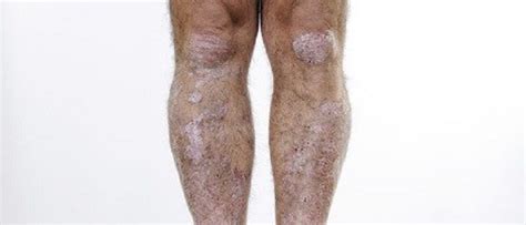 Understanding And Identifying The Potential Causes Of Dry Itchy Skin