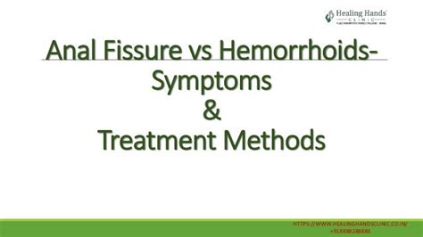 Anal Fissure Vs Hemorrhoids Symptoms And Treatment Methods