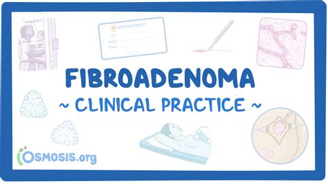 Fibroadenoma Clinical Sciences Osmosis Video Library