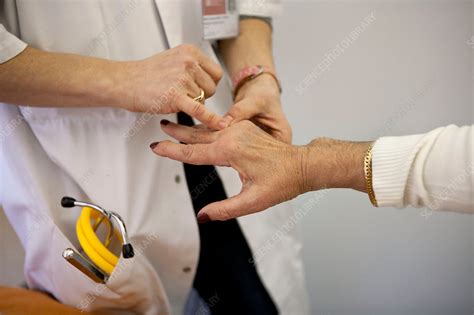 Arthritic Hand Joints Examination Stock Image C0107596 Science