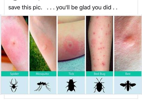 How To Identify Insect Bites🐜🦗 Follow Us For More Hacks😎 Insectbites