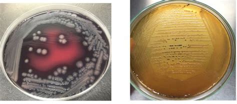 Salmonella Culture Morphology On Ss Agar And Xld Agar Download