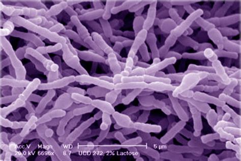 Bifidobacterias Aliadas Contra El Cáncer