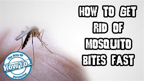 How To Get Rid Of Mosquito Bites Fast Youtube