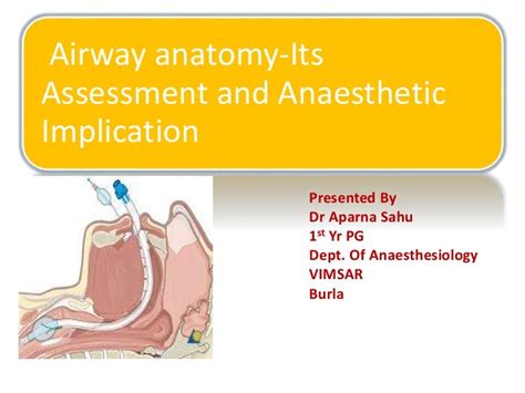Anatomy Of Airway For Intubation Anatomical Charts And Posters