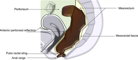 rectum drawing