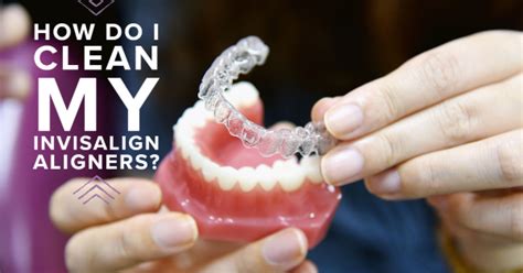 How Do I Clean My Invisalign Aligners Nowlin Orthodontics