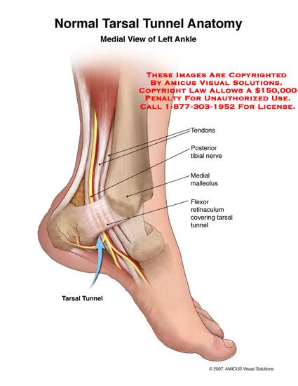 There are five flexor tendon zones in hand. (07007_01B) Normal Tarsal Tunnel Anatomy - Anatomy Exhibits