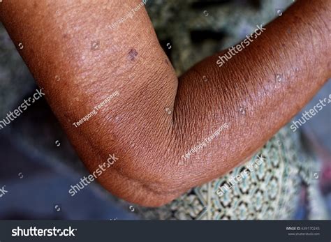 Wrinkled Arms Old Womans Selective Focus Stock Photo 639170245