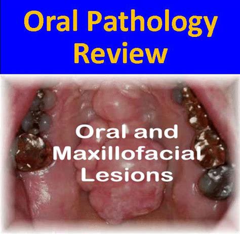 Dental Oral Pathology Review Agd Pace