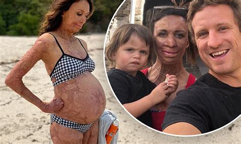 Burns Survivor Turia Pitt Reveals She Has Cut Back On Her Recovery Due To Her Pregnancy Daily