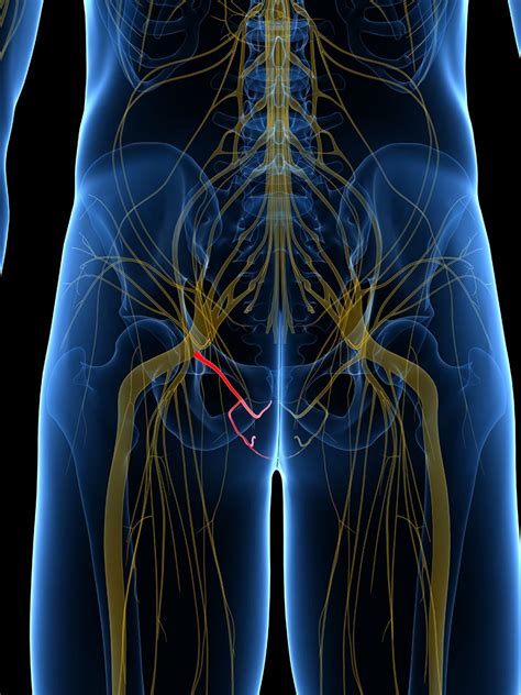 Pudendal Nerve Block Excel Pain And Spine