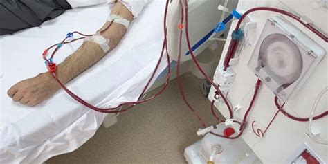 Hopper Congress Must Act Now To Protect Dialysis Patients