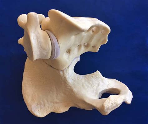 Workshop Bone Hemi Pelvis Sacrum L5 Diamedical Usa