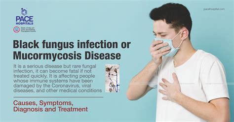 Black Fungus Infection Mucormycosis Disease Symptoms And Treatment