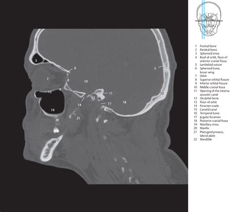 4 Sagittal Sections Radiology Key