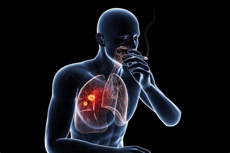 smoking and lung cancer lovetoknow