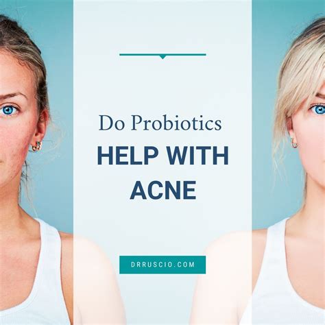 Do Probiotics Help With Acne Dr Michael Ruscio Bcdnm Dc