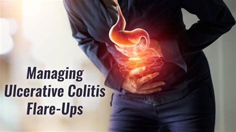 Tips On How To Manage An Ulcerative Colitis Flare Up