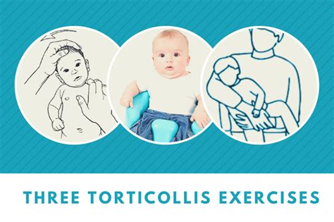 Will Torticollis Correct Itself Cranial Therapy Centers