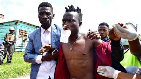 Music Producer For Ugandan Presidential Candidate Bobi Wine Wounded In