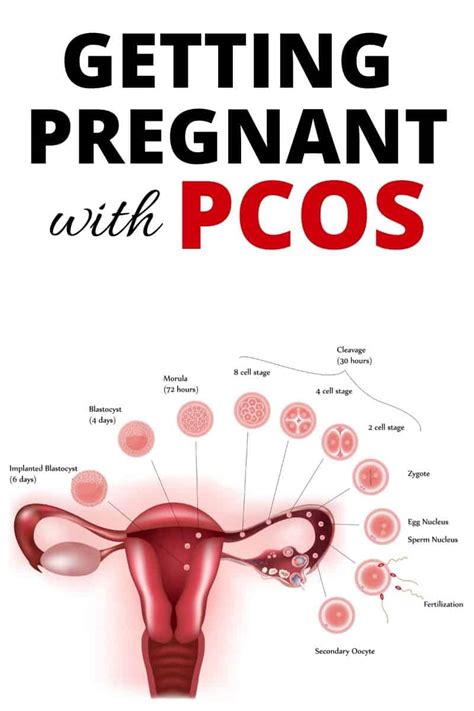 Pregnancy symptoms differ from woman to woman and pregnancy to pregnancy; Getting Pregnant with PCOS - yes, it's possible for you too!
