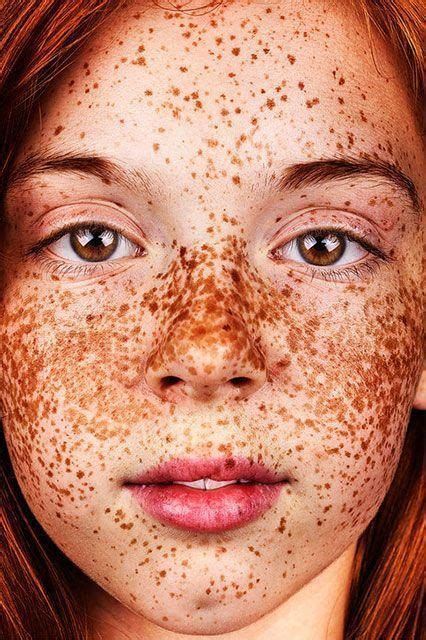 Breathtaking Photos Show The Undeniable Beauty Of Freckles Sardas