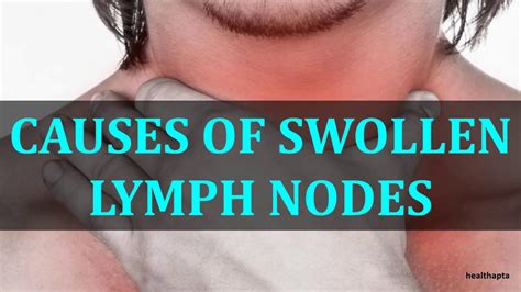 Causes For Swollen Lymph Nodes Under Arm