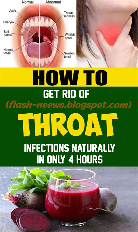 Some sore throat remedies only mask pain, but these treatments from doctors can cure your symptoms. Instructions to Get Rid of Throat Infections Naturally in ...