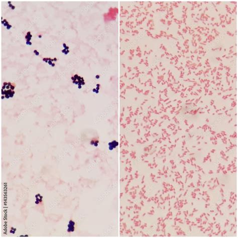 Smear Of Gram Positive Bacteria On The Left And Gram Negative Bacteria
