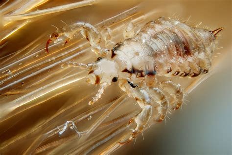 Where Do Head Lice Come From And How Do You Get Them