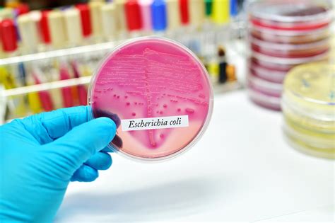 Coli — модельный организм без недостатков. E. coli-Bakterium: Darmkeim vermehrt in Deutschland ...
