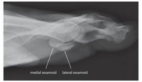 Diagnostic Imaging Techniques Of The Foot And Ankle Musculoskeletal Key