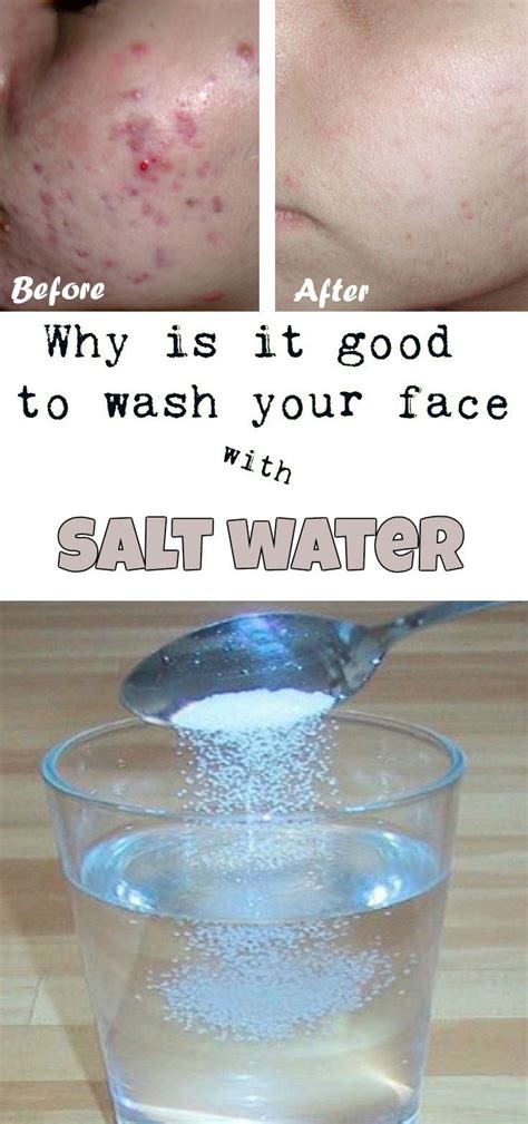 Why Is It Good To Wash Your Face With Salt Water