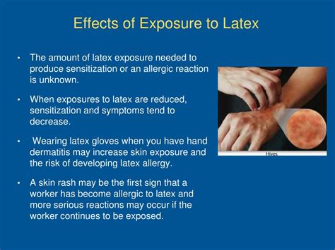 Ppt Latex Allergies Powerpoint Presentation Free Download Id307804