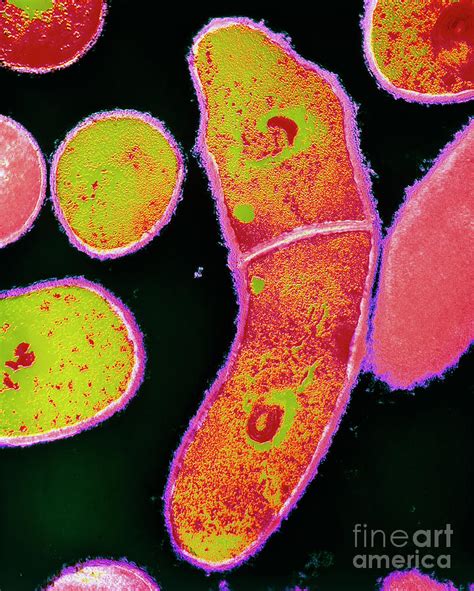 Corynebacterium Diphtheriae Bacteria Photograph By Dr Kari Lounatmaa