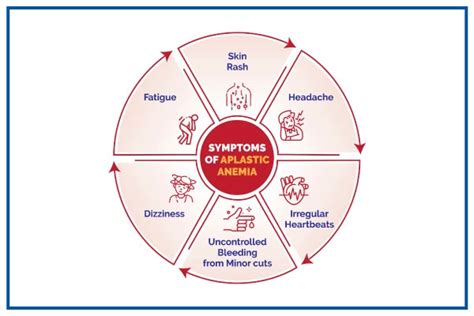 Aplastic Anemia Symptoms Causes And Treatment