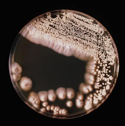 Petri Dish Of Trichosporon Cutaneum Photograph By John Durhamscience