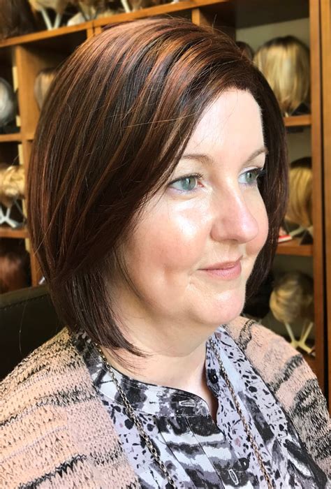 The reason the two are linked is that androgens, the male hormones that can cause hair loss, are also connected to prostate cancer. Hair loss and cancer treatment - Wigs Medical