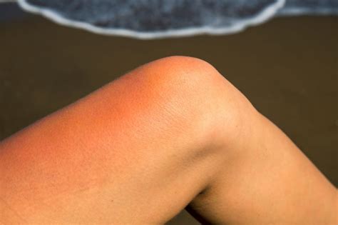 Warning Signs Of A Blood Clot In Your Leg Facty Health