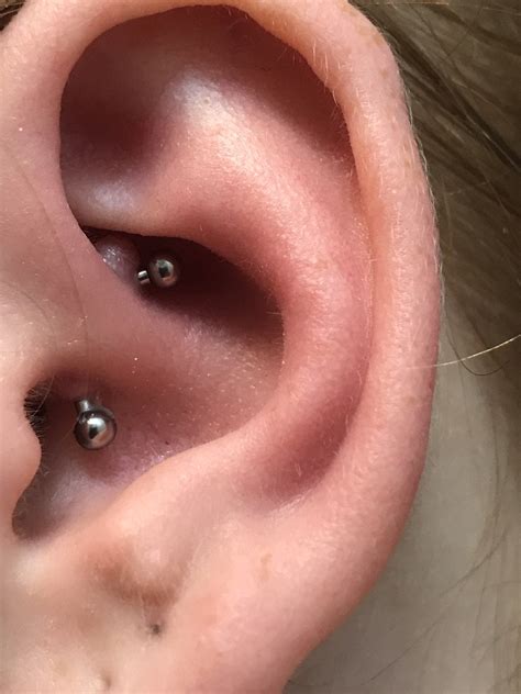 My Irritation Bump On My Daith Literally Dried Up And Fell Off In Only 5 Days Rpiercing