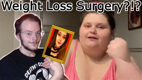 Ex Obese Man Reacts Amberlynn Reid Weight Loss Surgery Youtube