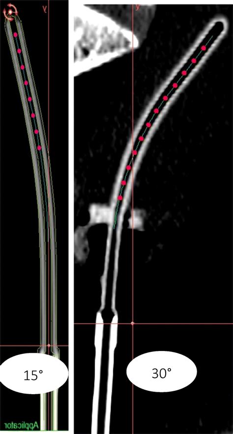 Ct Imaging For 15°and 30° Ctmr Applicators Along With Active Dwell