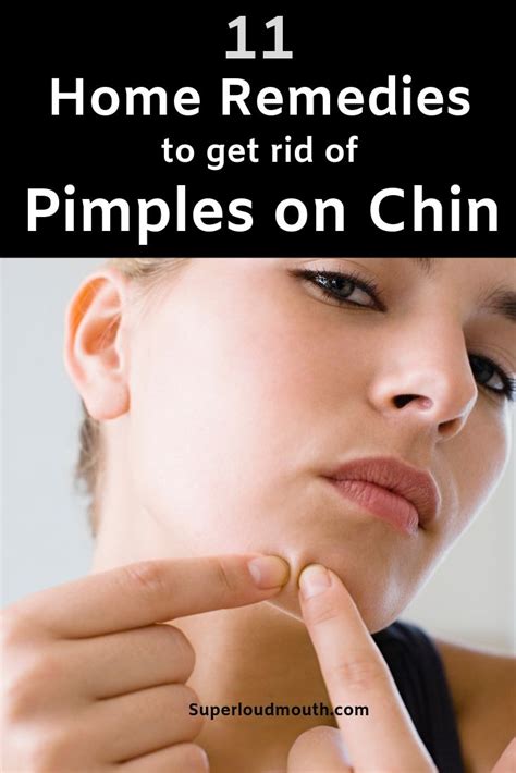 Pimples On Chin Meaning How To Get Rid Of Break Out On Chin Pimples
