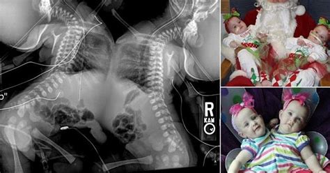 Amazing Stories Around The World Shocking X Ray Shows The Complicated Procedure Facing Doctors