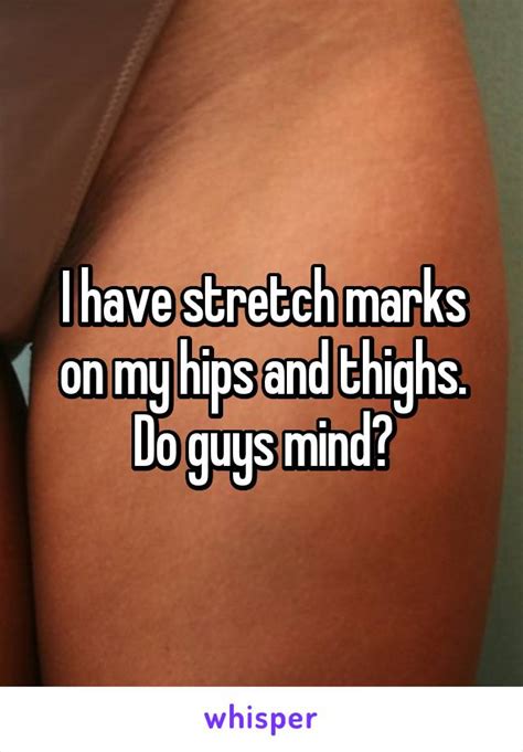 Stretch Marks On Hips The Letter Of Recomendation