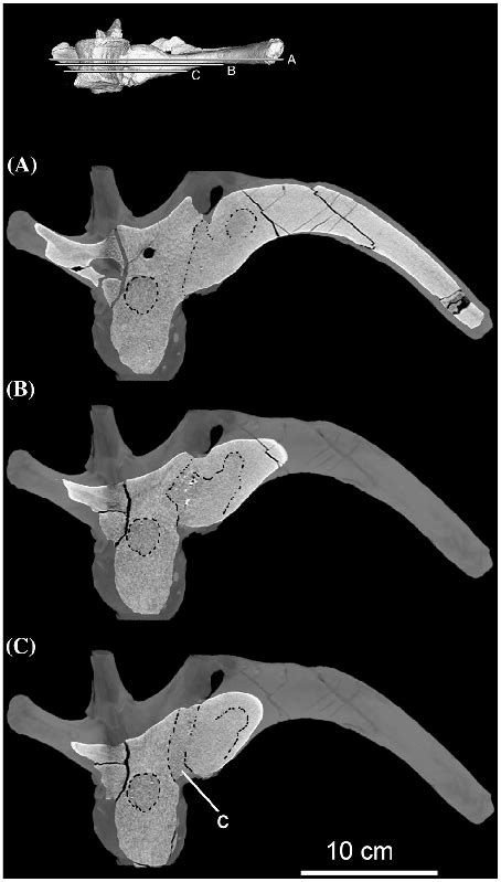 Ct Scan Images Ac Of The Dorsal Vertebra And The Proximal Part Of